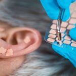 A cura tá na orelha! Descubra a auriculoterapia