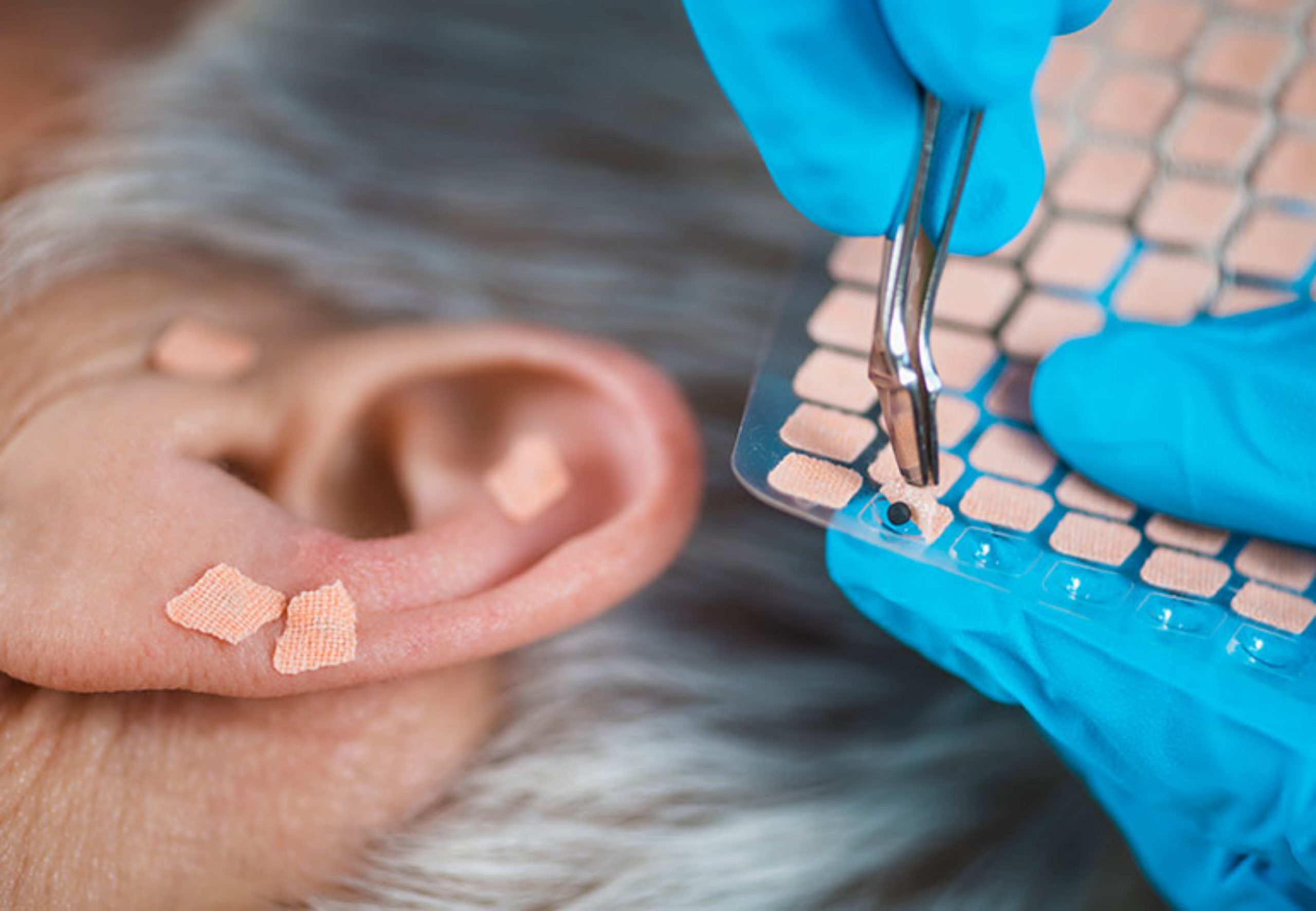 Você está visualizando atualmente A cura tá na orelha! Descubra a auriculoterapia